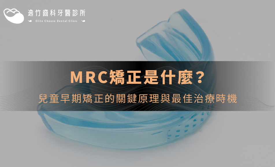 MRC矯正是什麼？兒童早期矯正的關鍵原理與最佳治療時機