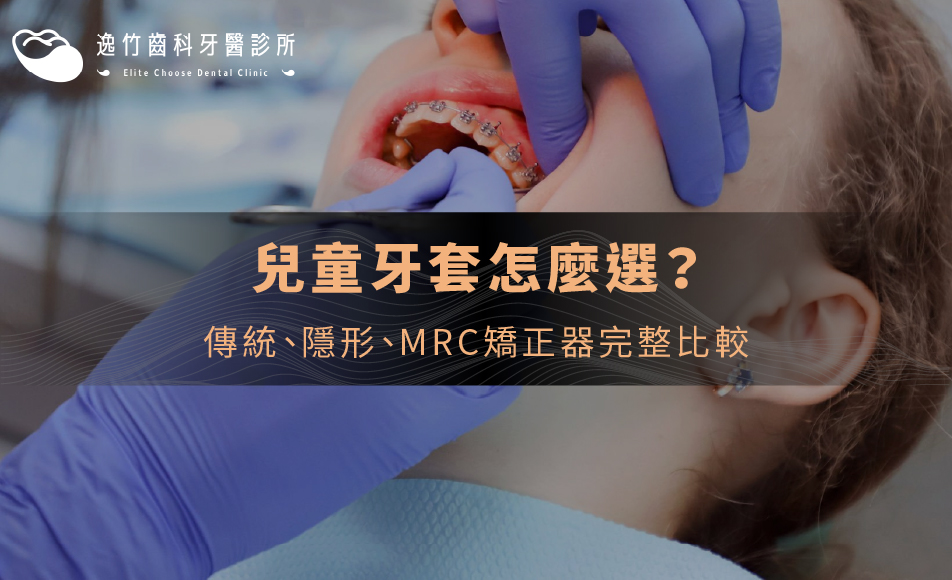 兒童牙套怎麼選？傳統、隱形、MRC矯正器完整比較