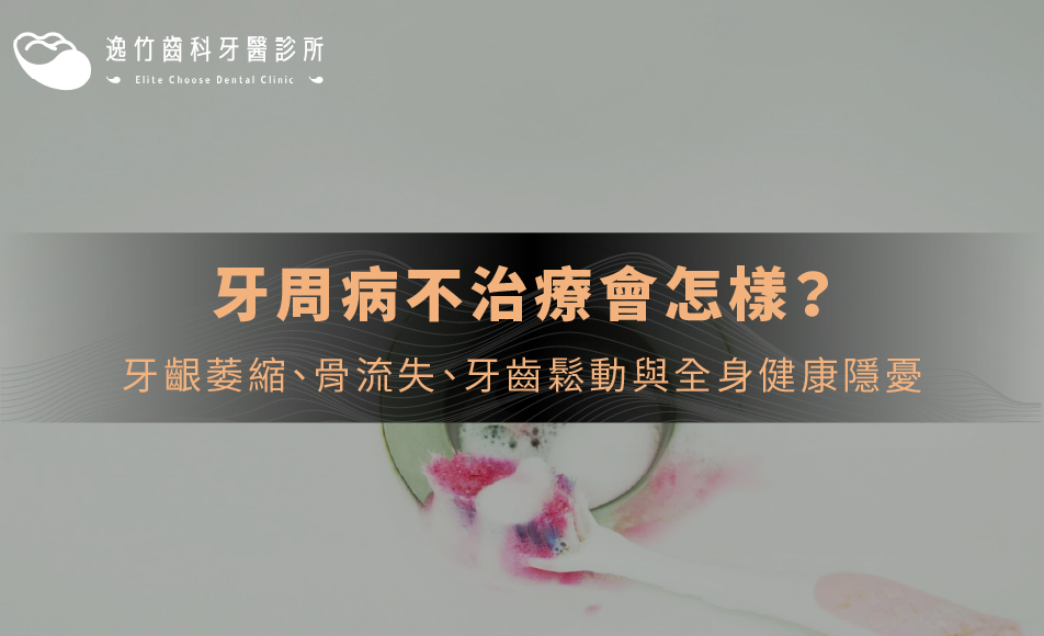 牙周病不治療會怎樣？牙齦萎縮、骨流失、牙齒鬆動與全身健康隱憂