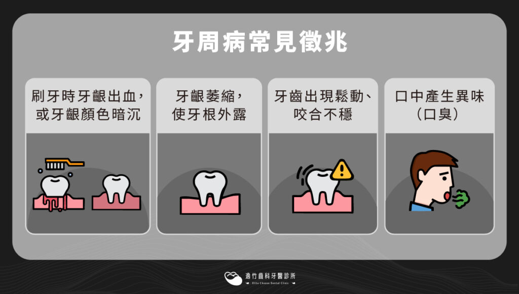 牙周病常見徵兆
